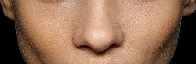 скулы скулы